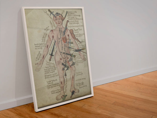 Vintage Anatomy Medicine Wall Art Medieval Poster Anatomy Wound Man Vintage Antique Poster Fine Art  Poster Art Gift 1543957108
