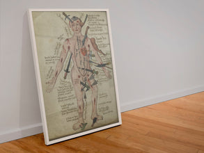 Vintage Anatomy Medicine Wall Art Medieval Poster Anatomy Wound Man Vintage Antique Poster Fine Art  Poster Art Gift 1543957108