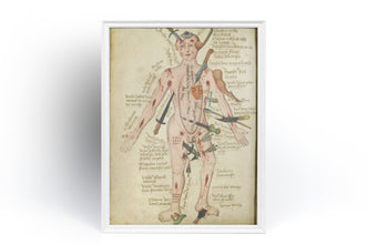 Vintage Anatomy Medicine Wall Art Medieval Poster Anatomy Wound Man Vintage Antique Poster Fine Art  Poster Art Gift 1543957108